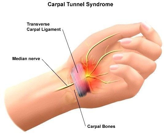 hand pain